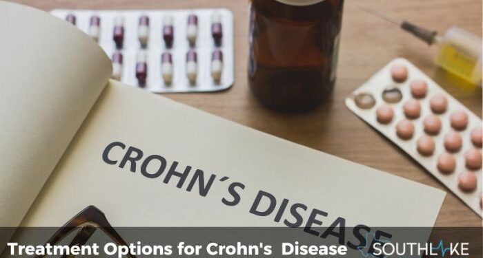 Crohn's disease - Cancer Therapy Advisor