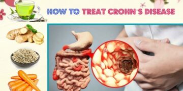 14 Self-Care Tips for Crohn's Disease